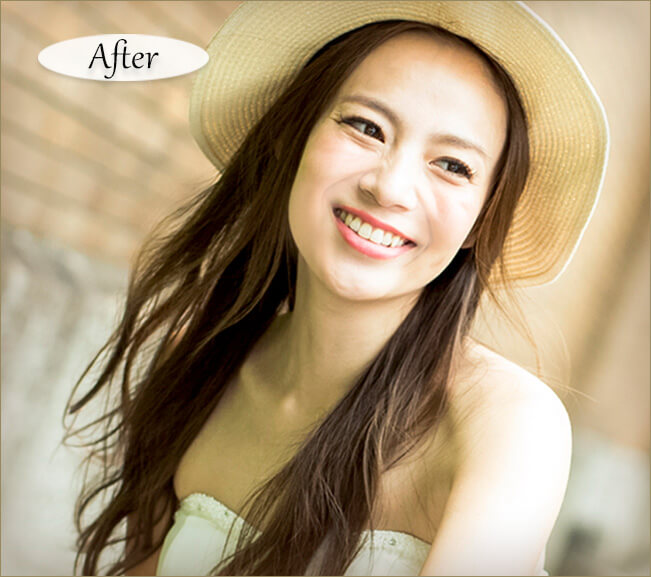 結婚式の写真 ほうれい線の補正後