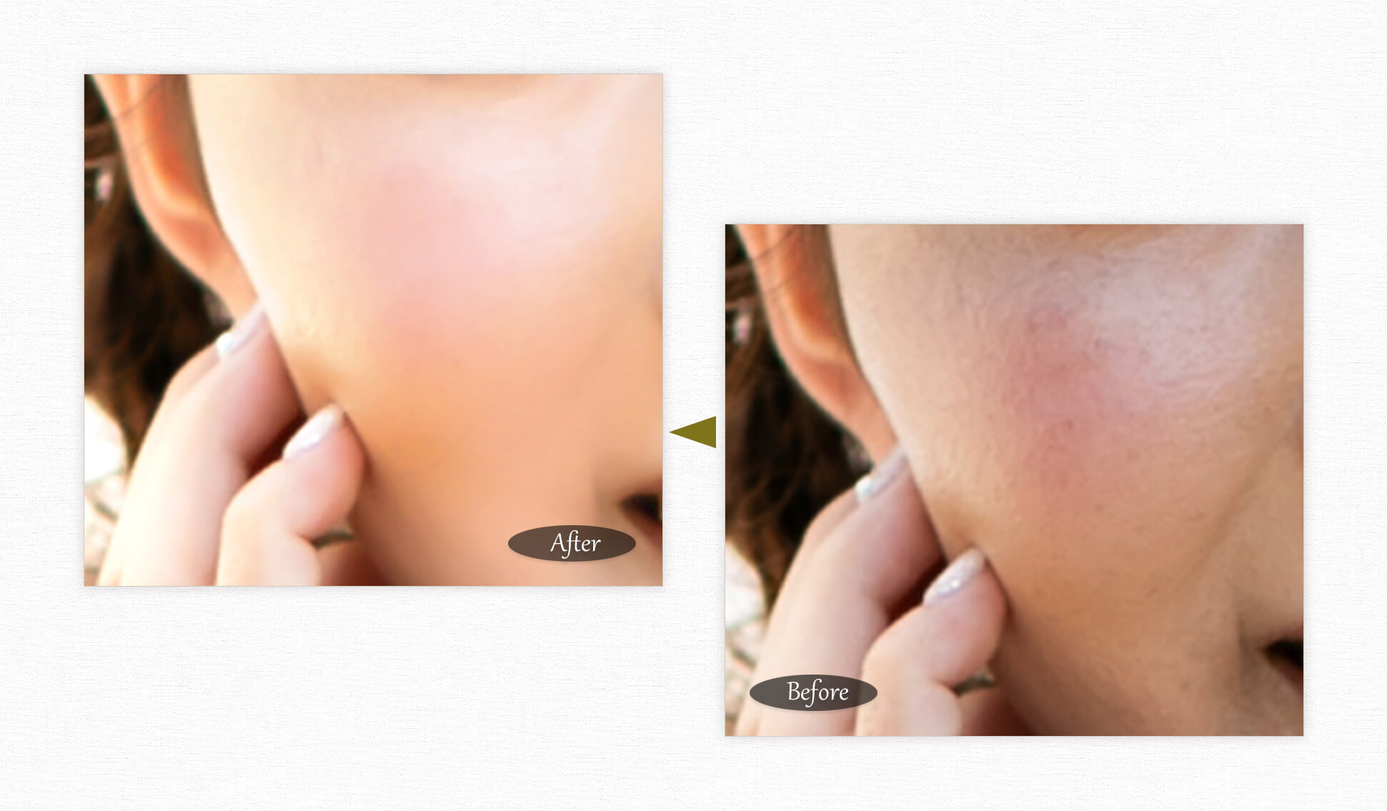 ウエディングの写真補正 肌荒れ